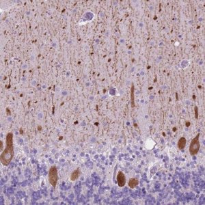 Anti-GRIN2B antibody produced in rabbit 