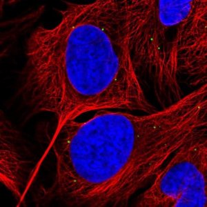Anti-GRK4 antibody produced in rabbit 