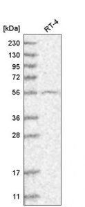 Anti-GRK4 antibody produced in rabbit 