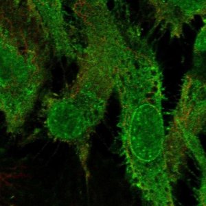Anti-GRK5 antibody produced in rabbit 