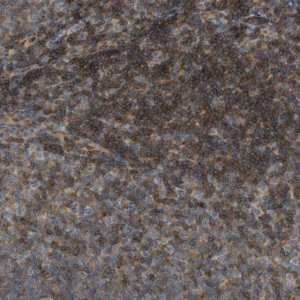 Anti-GRK6 antibody produced in rabbit 