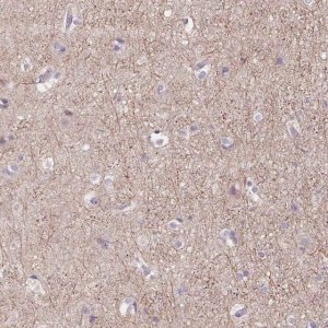 Anti-GRM2 antibody produced in rabbit 