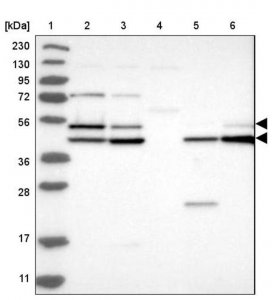 Anti-GSK3A antibody produced in rabbit 