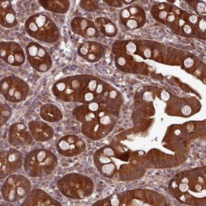 Anti-GSKIP antibody produced in rabbit 