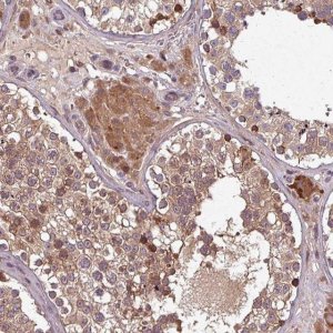 Anti-GSKIP antibody produced in rabbit 