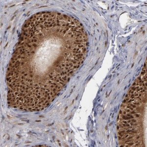 Anti-GSR antibody produced in rabbit 