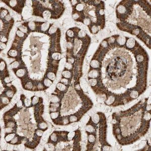 Anti-GSTK1 antibody produced in rabbit 
