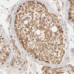 Anti-GSTZ1 antibody produced in rabbit HPA004701-100UL