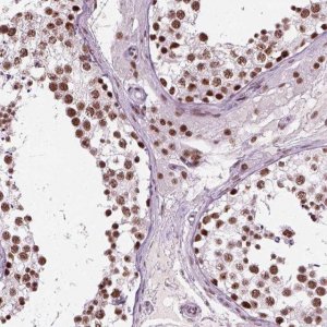Anti-GTF2F1 antibody produced in rabbit 