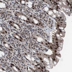 Anti-GTF2F2 antibody produced in rabbit 