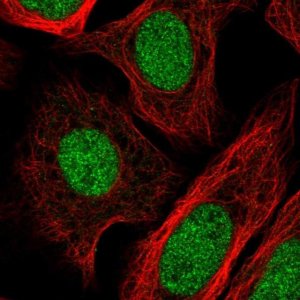 Anti-GTF2IRD2B antibody produced in rabbit 