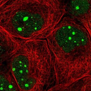 Anti-GTF3C1 antibody produced in rabbit 