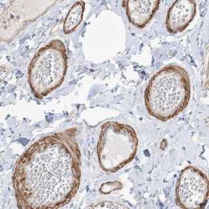 Anti-GTF3C2 antibody produced in rabbit 