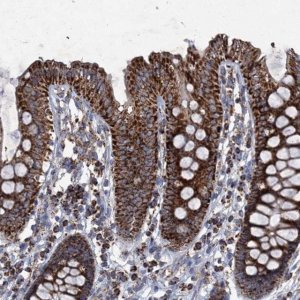 Anti-GTPBP3 antibody produced in rabbit 