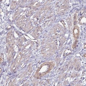 Anti-GTSE1 antibody produced in rabbit 