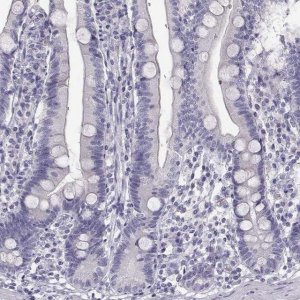 Anti-GUCA1A antibody produced in rabbit 