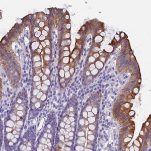 Anti-GUCA1C antibody produced in rabbit 