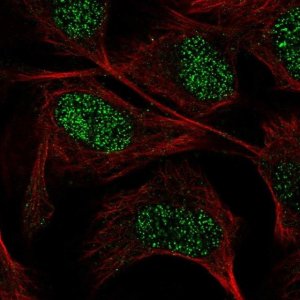 Anti-GUCY1A3 antibody produced in rabbit 
