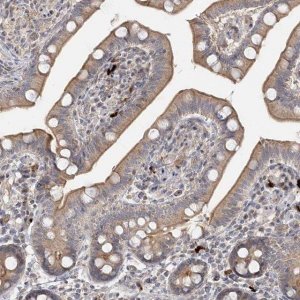 Anti-GUCY2C antibody produced in rabbit 