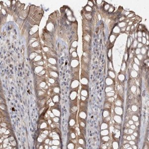 Anti-GUCY2C antibody produced in rabbit 