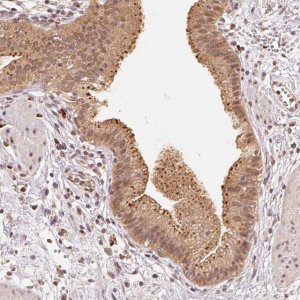 Anti-GUSB antibody produced in rabbit 