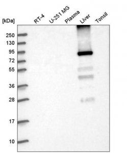 Anti-GYS2 antibody produced in rabbit 