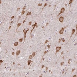 Anti-HABP4 antibody produced in rabbit 