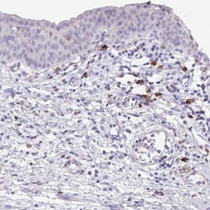 Anti-HACD4 antibody produced in rabbit HPA058666-100UL