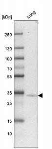 Anti-HACD4 antibody produced in rabbit HPA058666-100UL