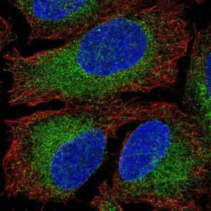 Anti-HACE1 antibody produced in rabbit 