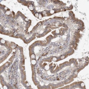 Anti-HACL1 antibody produced in rabbit 