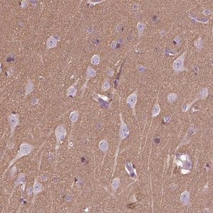 Anti-HAGHL antibody produced in rabbit 