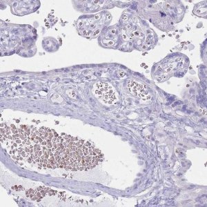 Anti-HBB antibody produced in rabbit 