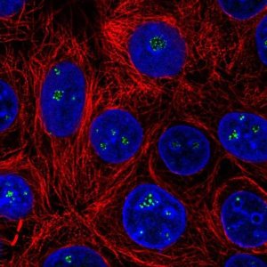 Anti-HDAC10 antibody produced in rabbit 
