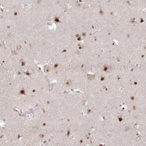 Anti-HDAC3 antibody produced in rabbit 