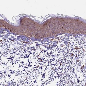 Anti-HDAC5 antibody produced in rabbit 
