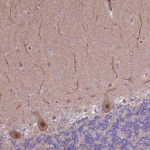 Anti-HDAC5 antibody produced in rabbit 