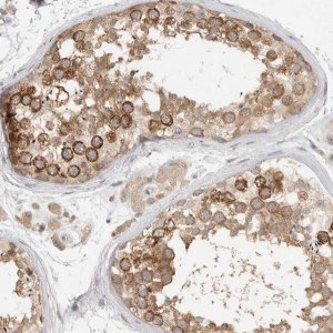 Anti-HDAC6 antibody produced in rabbit 