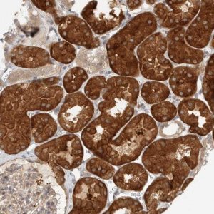 Anti-HDAC6 antibody produced in rabbit 