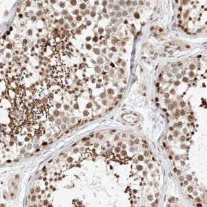 Anti-HDAC9 antibody produced in rabbit 