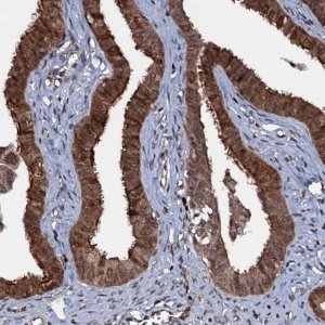 Anti-HDDC3 antibody produced in rabbit HPA040895-100UL