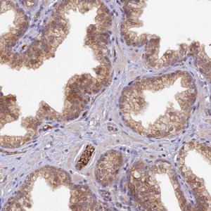 Anti-HDHD2 antibody produced in rabbit 