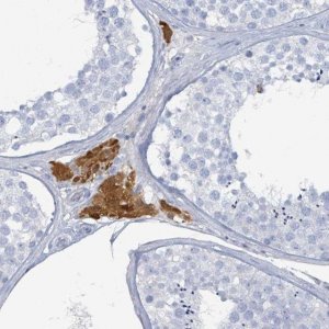 Anti-HEATR5A antibody produced in rabbit 