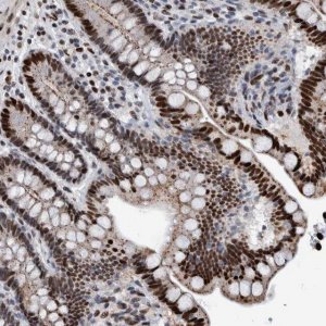 Anti-HEATR9 antibody produced in rabbit 