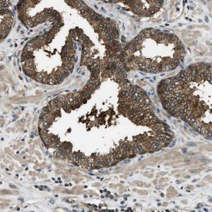 Anti-HEBP2 antibody produced in rabbit 