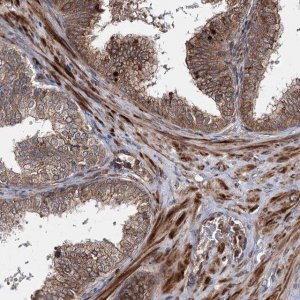 Anti-HECTD2 antibody produced in rabbit 