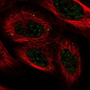Anti-HECTD4 antibody produced in rabbit 