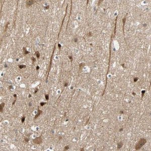 Anti-HECW1 antibody produced in rabbit 