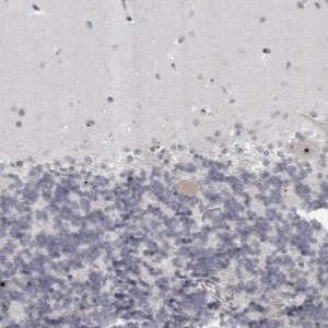 Anti-HELZ antibody produced in rabbit 