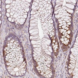 Anti-HERC2 antibody produced in rabbit 